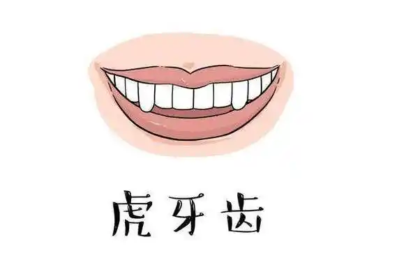 西安画美医疗美容医院-成年人可以矫正虎牙吗