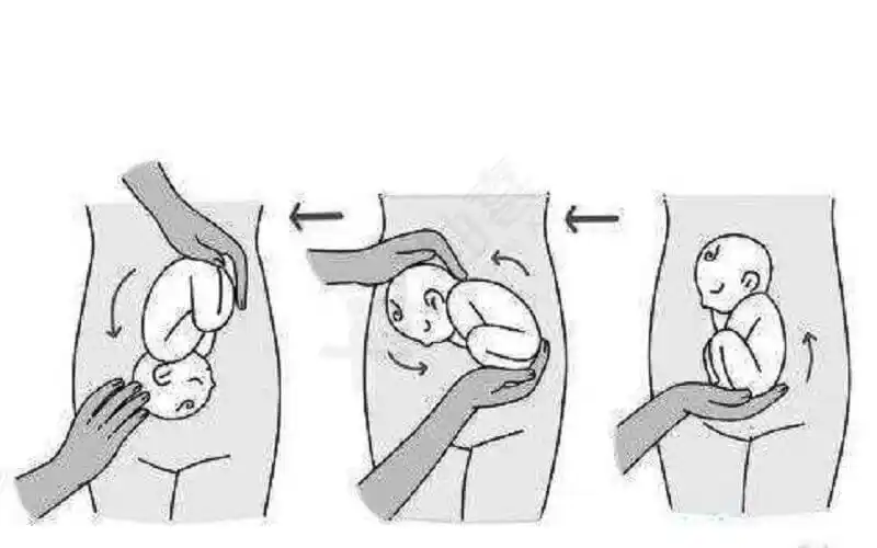 建议收藏的5个纠正方法等孕晚期胎位不正可就晚了