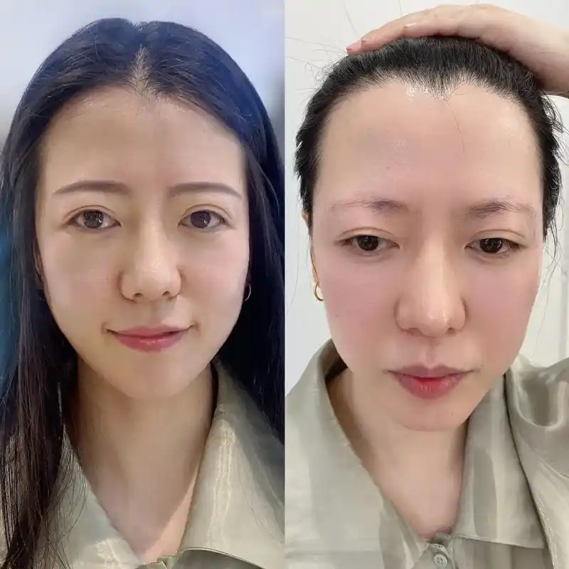 长脸女生如何选择适合自己的眉毛.##改眉前后对比 #眉型设计 - 抖音