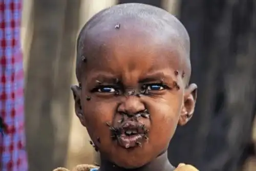 原创 非洲小男孩身上爬满了苍蝇,眼神透露着无奈, 活下来是他们最大的