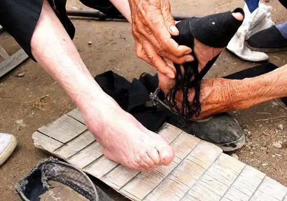 这位百岁老人在年幼的时候就开始裹脚,缠足是中国在