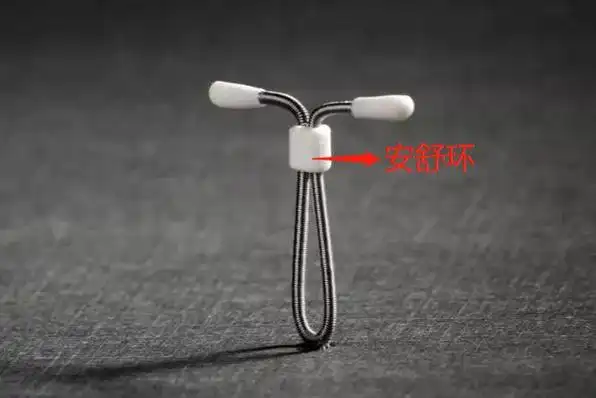 节育环有哪几种图片