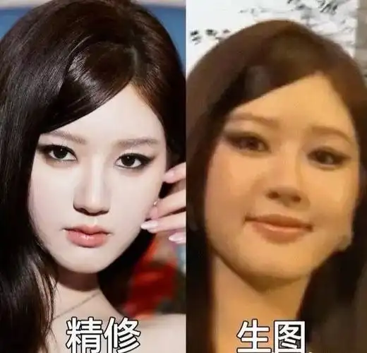 赵露思"丑照"真实内情曝光!得了荨麻疹在吃中药调理,所以发胖