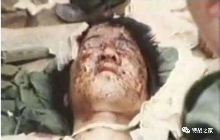 对越反击战他拉响手雷和越军抱在一起越军被炸死他活了下来