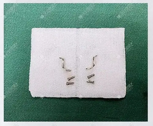 取出的钛钉材料