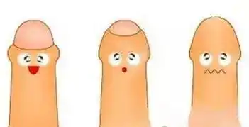 几乎每一个正常新生儿及婴幼儿都存在先天性包茎,2-3岁以下男童多为