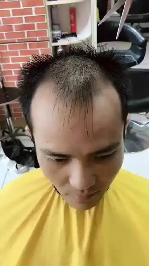 前额两边秃顶最适合的发型[给力] #心动的感觉