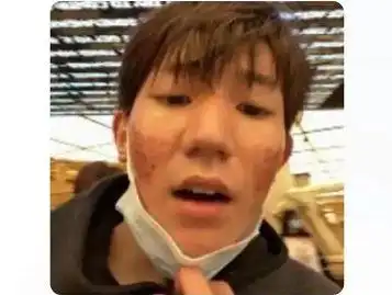 从照片中可以看到,王源的脸上长满了痘痘,看起来就像月球的表面一样坑