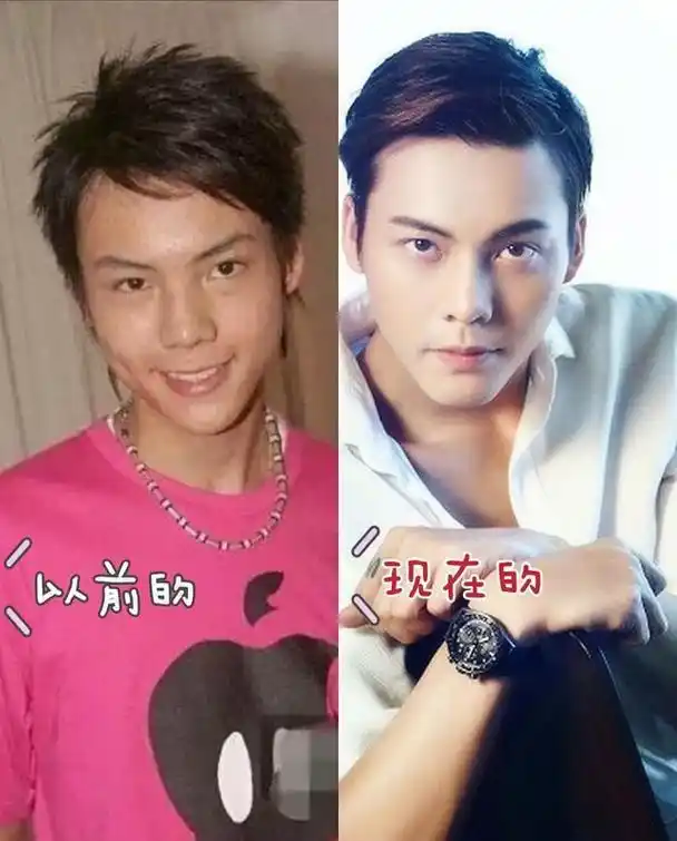 从相貌平平到帅气迷人,这几位男星动脸前后变化大,有你偶像吗?