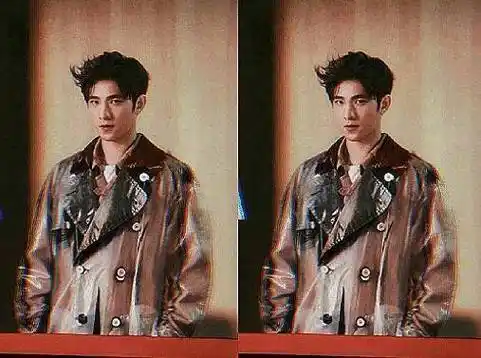 杨洋参加综艺时被曝光生图,镜头拉近看到满脸的伤痕后,我心疼了_因为