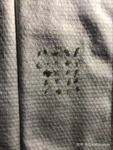 环切包皮手术大家的钛钉都是多久掉了啊大家用盐水泡了吗我两周才掉了