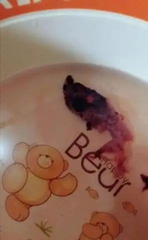 怀孕7周去医院检查说是停育了然后开了流产的药吃了两次就掉下来这个