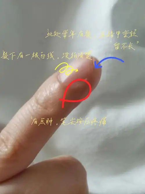 指甲开裂指甲按压疼痛