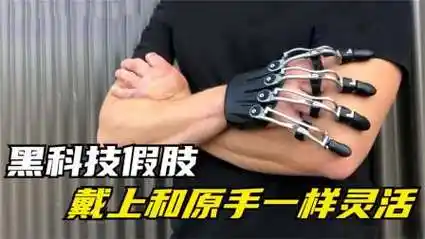 国外牛人发明智能假肢,截止病人佩戴上后,就和原手一样灵活