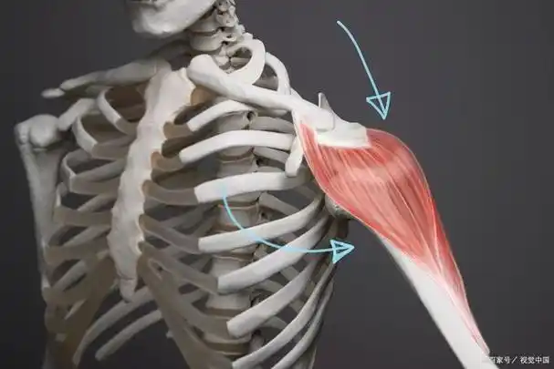 冈上肌肌腱部分撕裂怎么办?