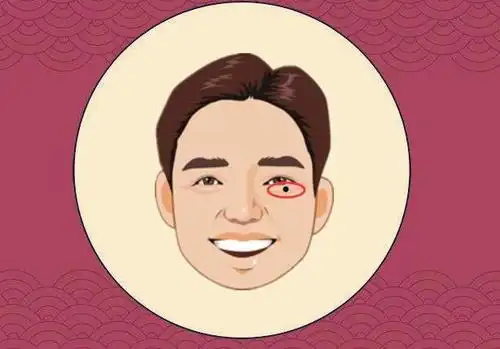 六种破财的恶痣左手进右手出两手空空生活一贫如洗