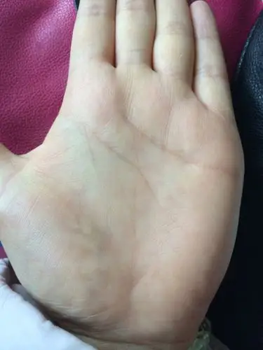 有没有会看手相的 帮我看看吧 我没有生命线 这怎么回事?