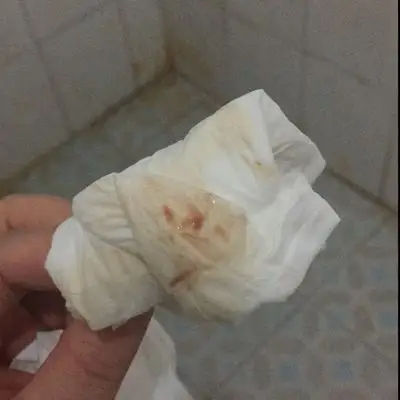 孕5周多 上厕所时发现阴道褐色分泌物 这是什麼徵兆 百度了下 说是