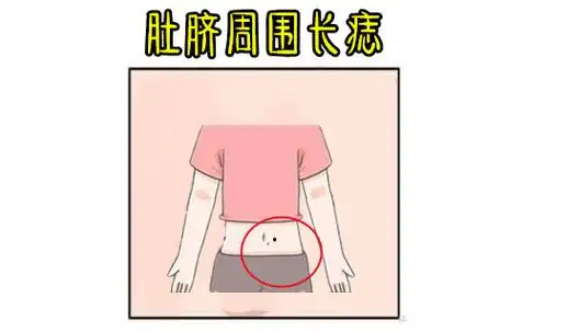 男人肚脐上方长痣好不好(男人肚脐上方长痣好不好图片)