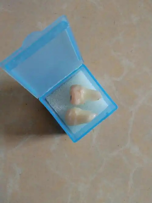 它自己就横向长,最终压迫到其他牙齿和牙神经,痛的还是自己现在拔掉了