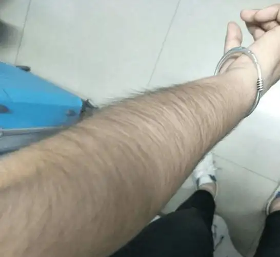 为什么有的女生体毛浓密有的女生体毛却很少原因是什么