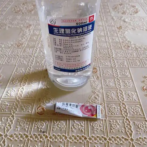 生理盐水和红霉素眼膏真的是个好东西,加起来不超过十块钱!