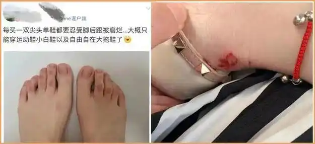 "镂空"休闲鞋穿上比光脚还舒服!