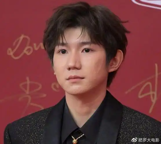 18, 王源:黑色闪钻 ,痘痘抢眼