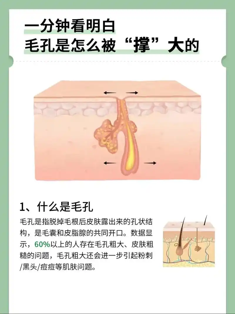 毛孔粗大怎么办71分清毛孔粗大类型,正确护.