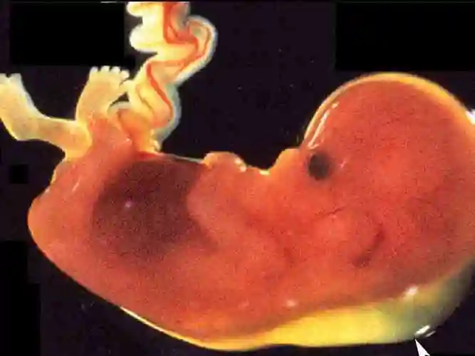 孕囊- 计算公式,成长周期,看男女方法,流产方法 - 姐妹邦