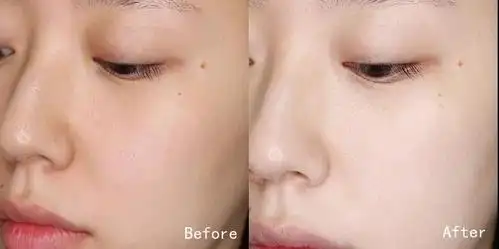 美白秘籍 ▎2021最佳美白方案