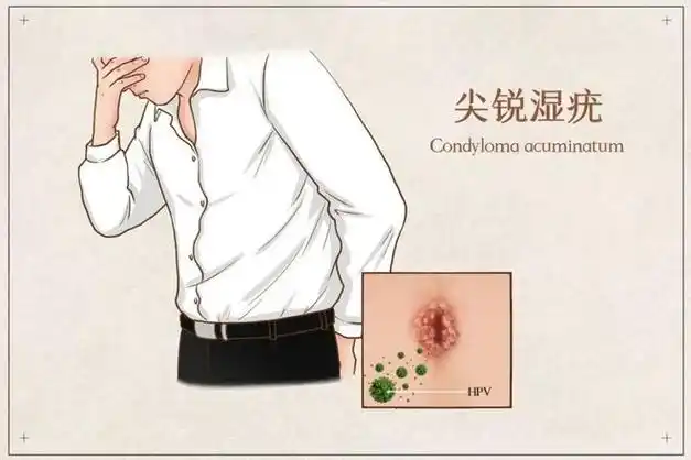 皮防科普|女性私处长痘痘是性病吗?|湿疣|痤疮|毛囊炎_网易订阅