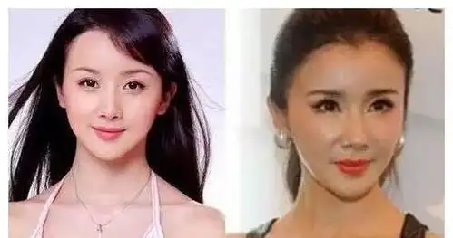 整容失败的5位女明星第2位越来越像男人第5位像老巫婆