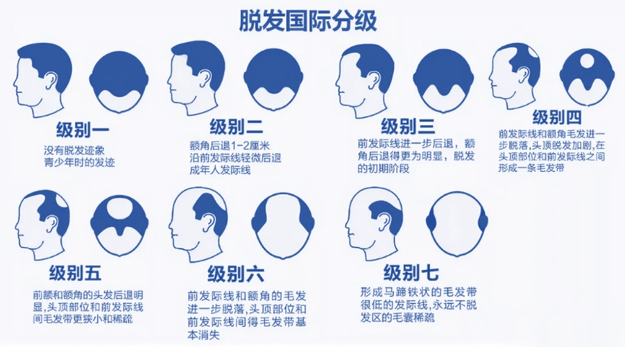 金笔奖何以止秃脱发药物发展现状分析