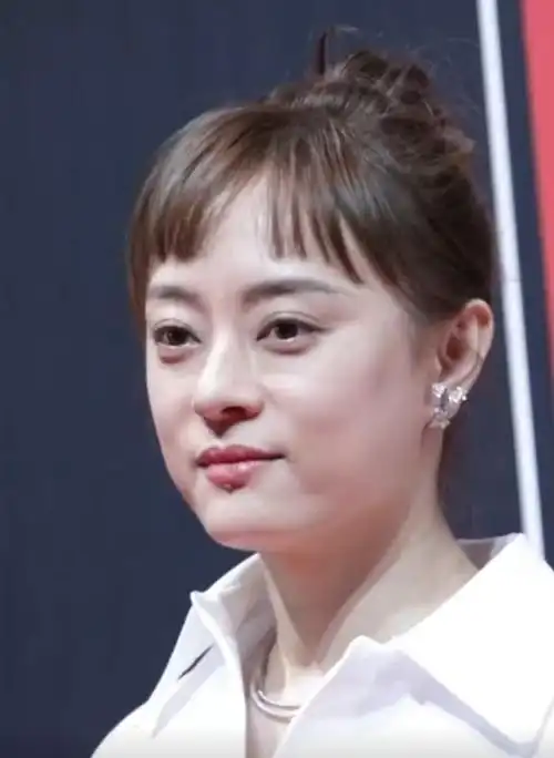 孙俪养生多度遭反噬脸上皮肤蜡黄下垂严重和普通妇女没啥区别