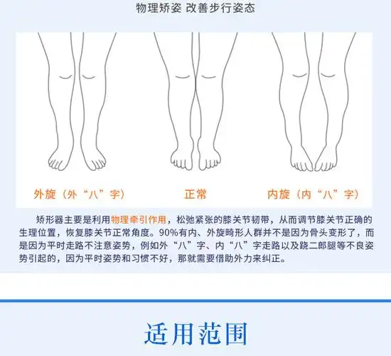 内八字和外八字的区别:鞋子反穿是矫正内八字还是外八字