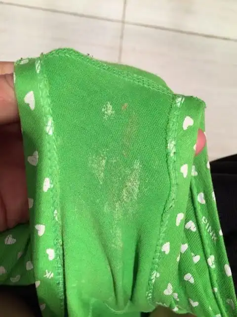 宝妈们帮忙看看白带这样正常吗?谢谢了.