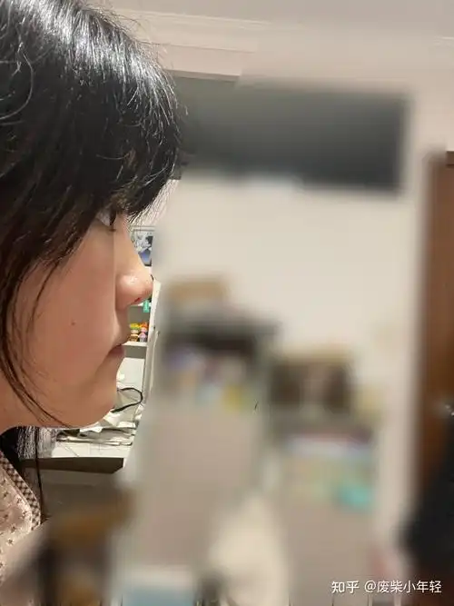 有一个超级扁平的侧脸是一种什么样的体验