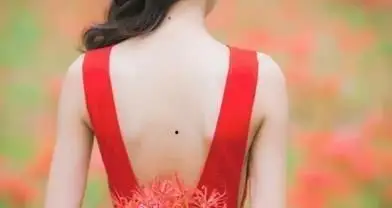 后背长痣代表富贵,是真的吗?