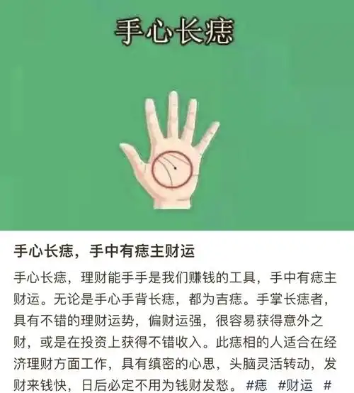 04左手手心痣,玄学之谜解开?