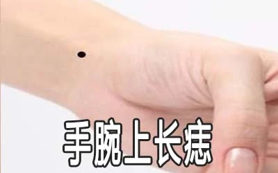 手腕上长痣会影响运势吗