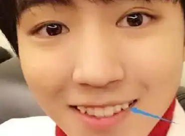 有人说长虎牙的人有点"虎",你认可?