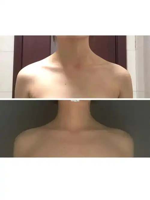 有斜方肌的女生6015请立马把这两个动作练起来