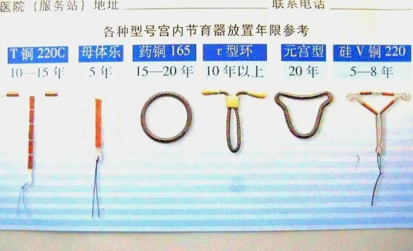 节育环 节育环也有很多讲究,最好要在超导引导下操作,保证位置准确
