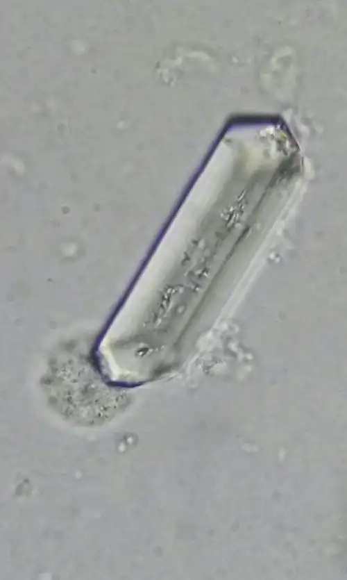 磷酸铵镁结晶#尿#体液检录