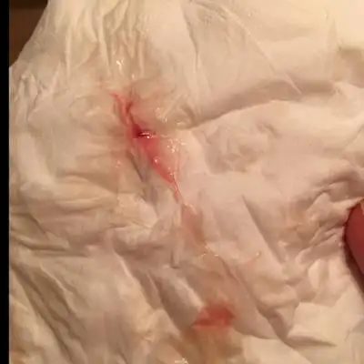 见红就这一点,还是还会持续性见红?