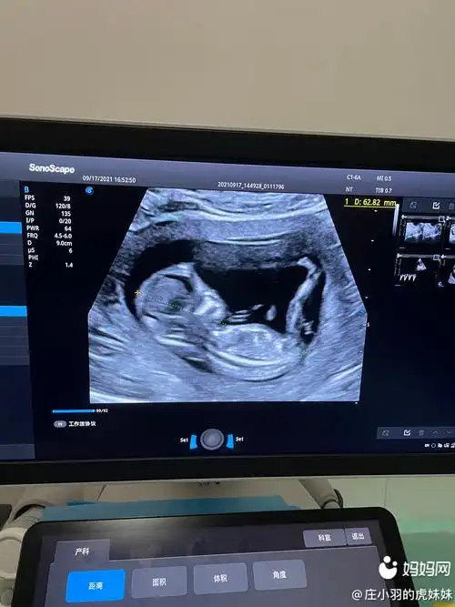 nt做了四次,不是侧睡就是趴着,还是过了,一切正正 | 妈妈网轻聊_千万