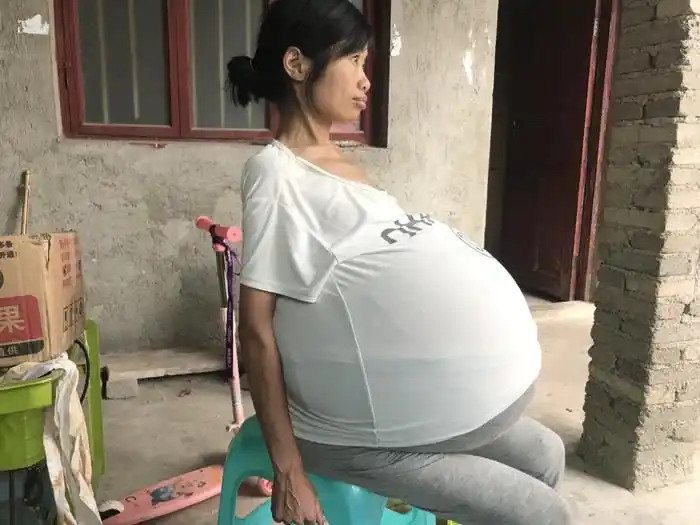 别人见她肚子如此之大,便会询问其是否怀上了多胞胎,此时,她也无话好