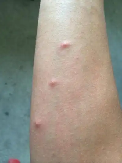 艾滋病红点图片 (52)