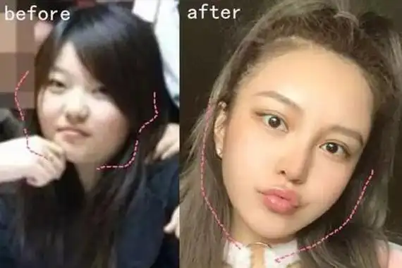 周扬青前后对比 之前也很漂亮现在更漂亮